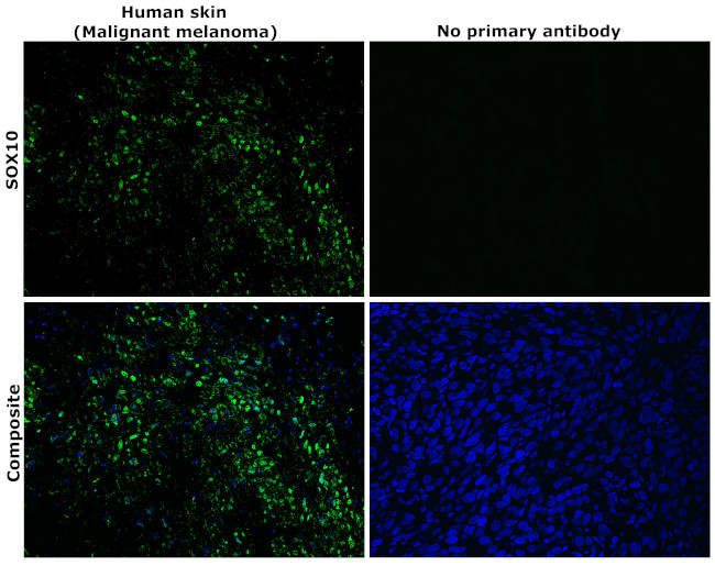 SOX10 Antibody in Immunohistochemistry (Paraffin) (IHC (P))