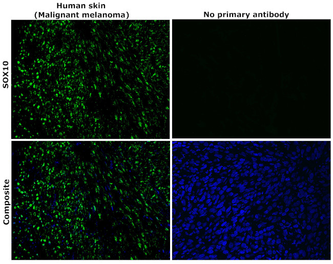 SOX10 Antibody in Immunohistochemistry (Paraffin) (IHC (P))