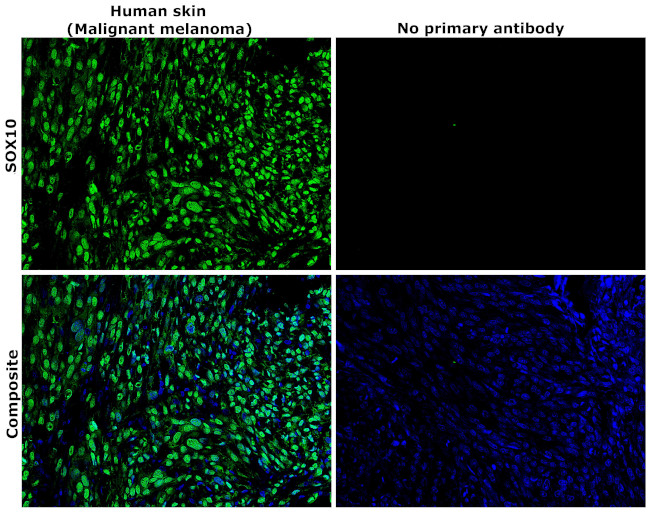 SOX10 Antibody in Immunohistochemistry (Paraffin) (IHC (P))