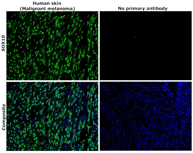 SOX10 Antibody in Immunohistochemistry (Paraffin) (IHC (P))