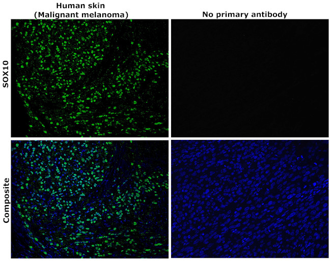 SOX10 Antibody in Immunohistochemistry (Paraffin) (IHC (P))