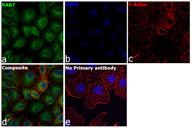 RAB7A Antibody in Immunocytochemistry (ICC/IF)