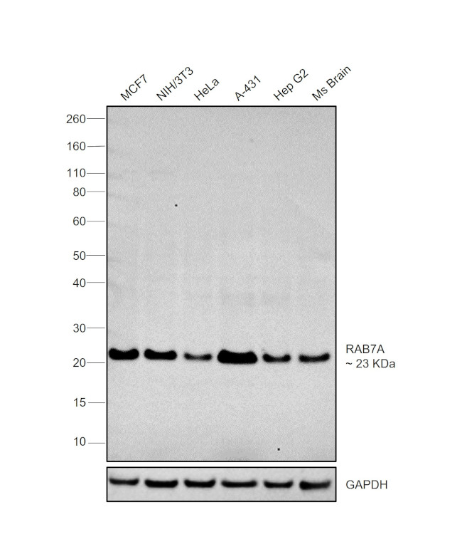 RAB7A Antibody in Western Blot (WB)