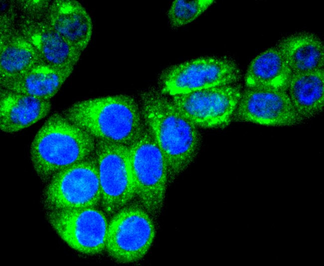 RAB7A Antibody in Immunocytochemistry (ICC/IF)