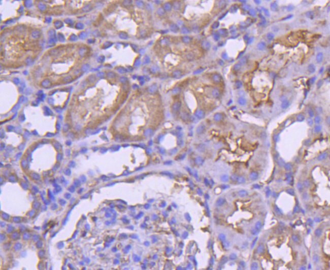 RAB7A Antibody in Immunohistochemistry (Paraffin) (IHC (P))