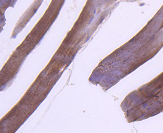 RAB7A Antibody in Immunohistochemistry (Paraffin) (IHC (P))