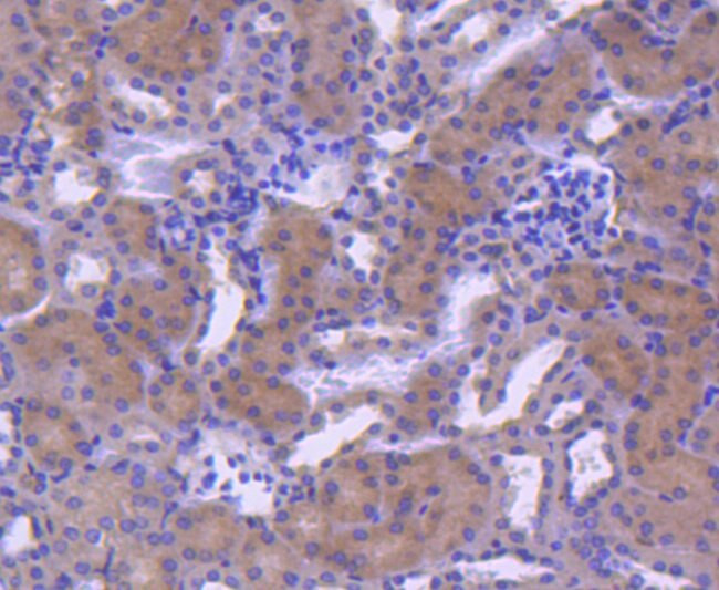 RAB7A Antibody in Immunohistochemistry (Paraffin) (IHC (P))