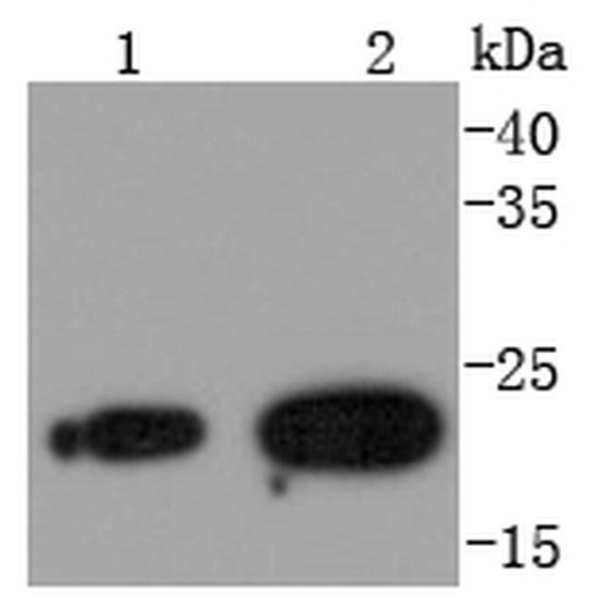 RAB7A Antibody in Western Blot (WB)