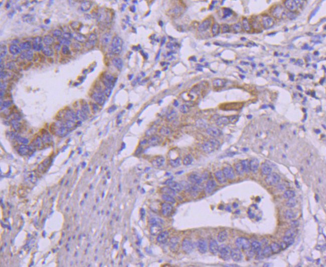 RET Antibody in Immunohistochemistry (Paraffin) (IHC (P))