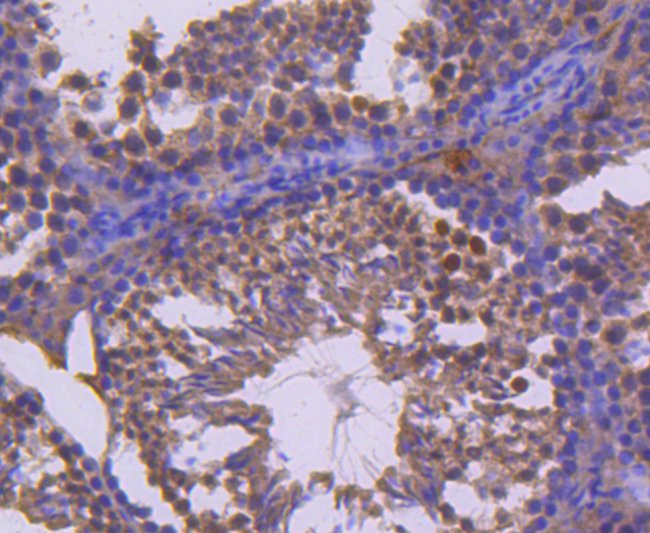 RET Antibody in Immunohistochemistry (Paraffin) (IHC (P))