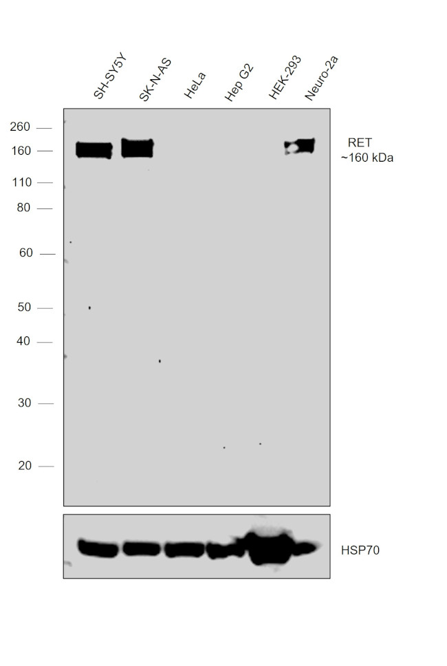 RET Antibody in Western Blot (WB)