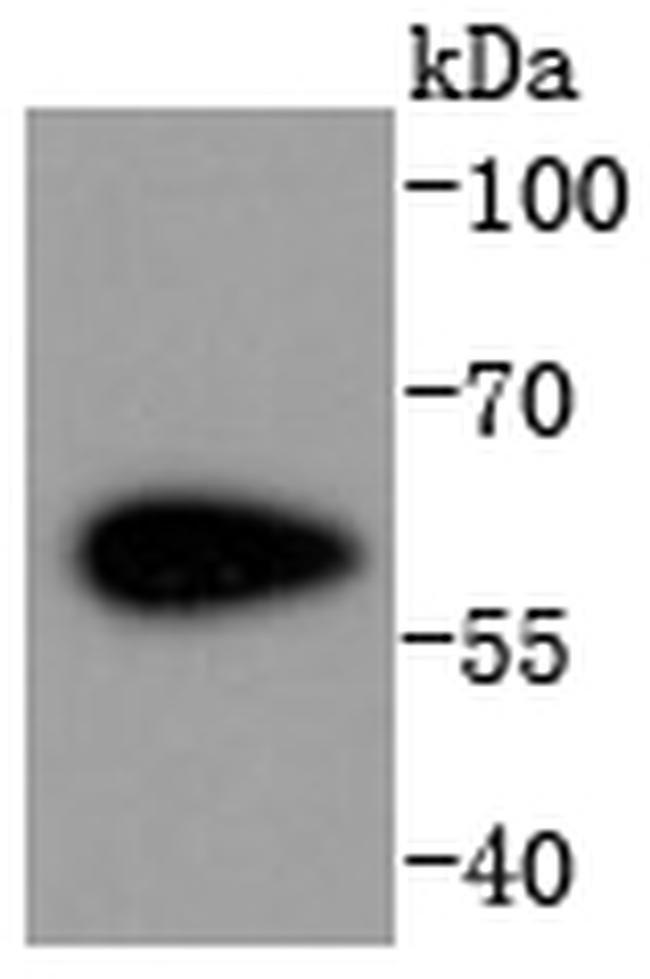 CDK8 Antibody in Western Blot (WB)