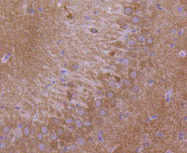 GluR1 Antibody in Immunohistochemistry (Paraffin) (IHC (P))