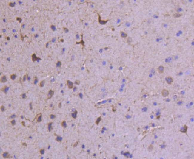 GluR1 Antibody in Immunohistochemistry (Paraffin) (IHC (P))