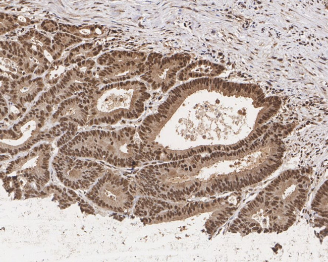 Cyclin E Antibody in Immunohistochemistry (Paraffin) (IHC (P))