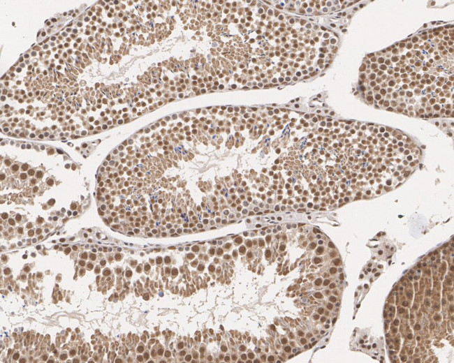 Cyclin E Antibody in Immunohistochemistry (Paraffin) (IHC (P))