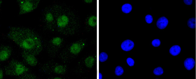 RelB Antibody in Immunocytochemistry (ICC/IF)