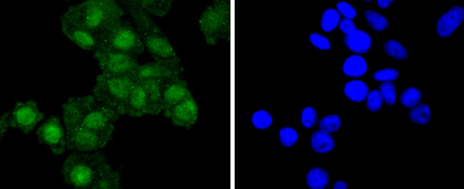 RelB Antibody in Immunocytochemistry (ICC/IF)