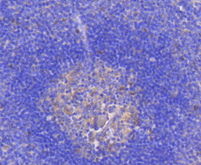 RelB Antibody in Immunohistochemistry (Paraffin) (IHC (P))