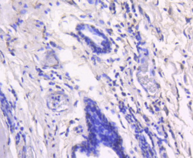 RelB Antibody in Immunohistochemistry (Paraffin) (IHC (P))