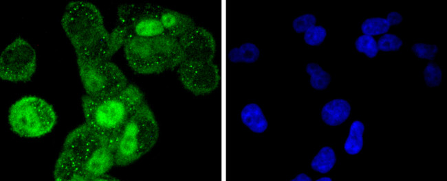 Cyclin A2 Antibody in Immunocytochemistry (ICC/IF)