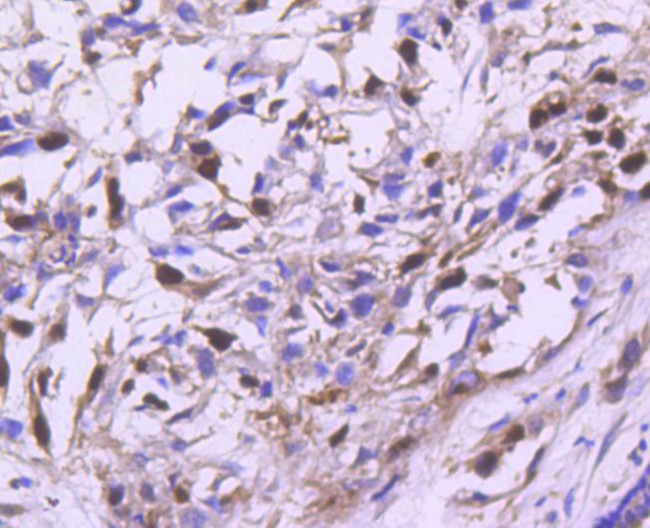 Cyclin A2 Antibody in Immunohistochemistry (Paraffin) (IHC (P))