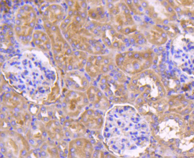 PDPK1 Antibody in Immunohistochemistry (Paraffin) (IHC (P))