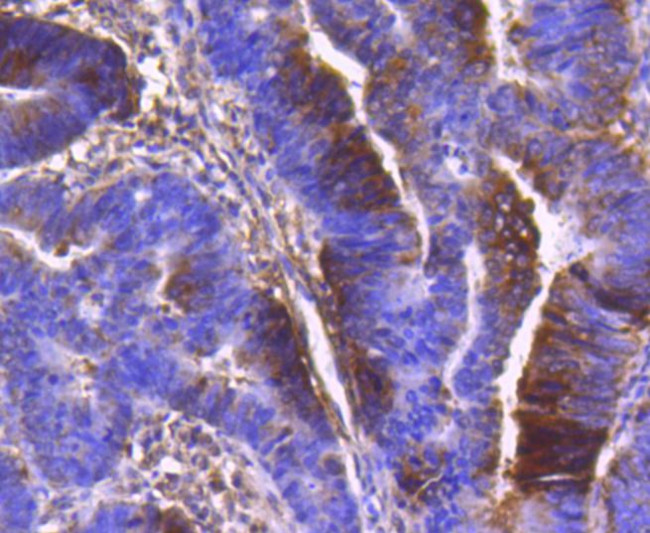 PDPK1 Antibody in Immunohistochemistry (Paraffin) (IHC (P))