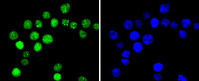 Phospho-Cyclin E (Thr77) Antibody in Immunocytochemistry (ICC/IF)