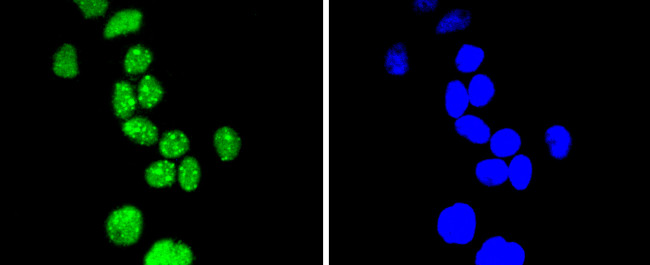 Phospho-Cyclin E (Thr77) Antibody in Immunocytochemistry (ICC/IF)