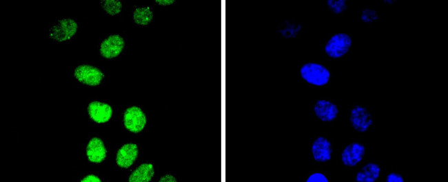 Phospho-Cyclin E (Thr77) Antibody in Immunocytochemistry (ICC/IF)