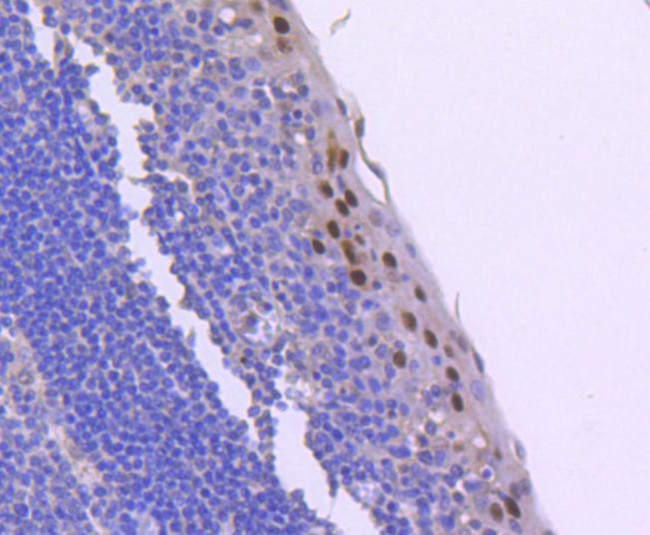 Phospho-Cyclin E (Thr77) Antibody in Immunohistochemistry (Paraffin) (IHC (P))