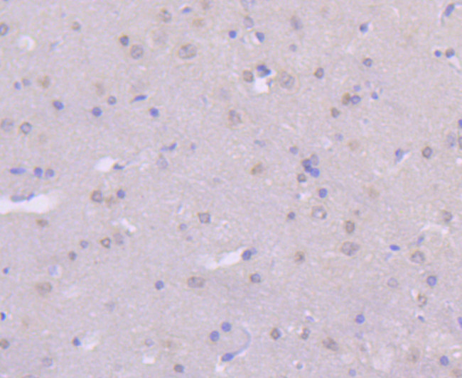 MKK7 Antibody in Immunohistochemistry (Paraffin) (IHC (P))