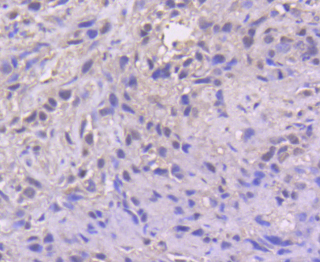 ATF4 Antibody in Immunohistochemistry (Paraffin) (IHC (P))