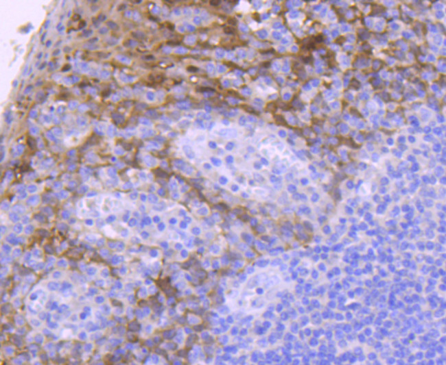 14-3-3 sigma Antibody in Immunohistochemistry (Paraffin) (IHC (P))