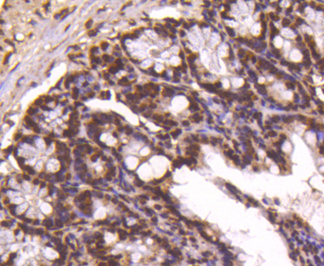 Histone H4 Antibody in Immunohistochemistry (Paraffin) (IHC (P))