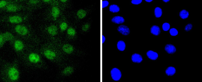 RUNX1/RUNX2/RUNX3 Antibody in Immunocytochemistry (ICC/IF)