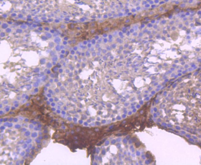 RUNX1/RUNX2/RUNX3 Antibody in Immunohistochemistry (Paraffin) (IHC (P))