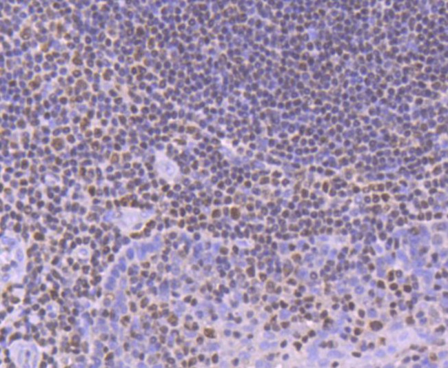 RUNX1/RUNX2/RUNX3 Antibody in Immunohistochemistry (Paraffin) (IHC (P))