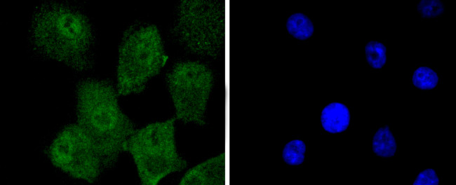 TRIM28 Antibody in Immunocytochemistry (ICC/IF)