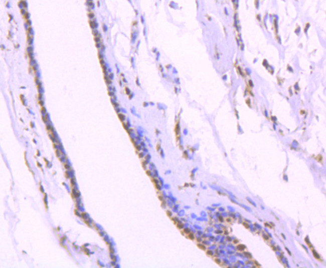 TRIM28 Antibody in Immunohistochemistry (Paraffin) (IHC (P))