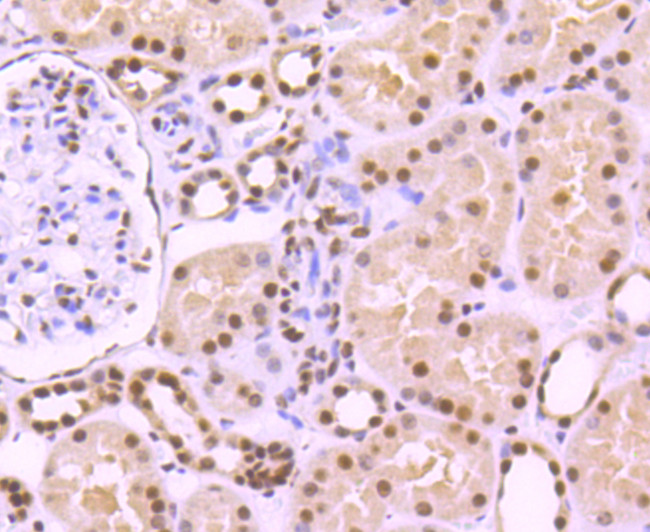 TRIM28 Antibody in Immunohistochemistry (Paraffin) (IHC (P))