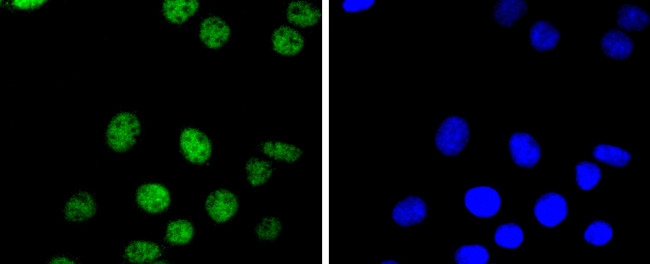 PAX8 Antibody in Immunocytochemistry (ICC/IF)