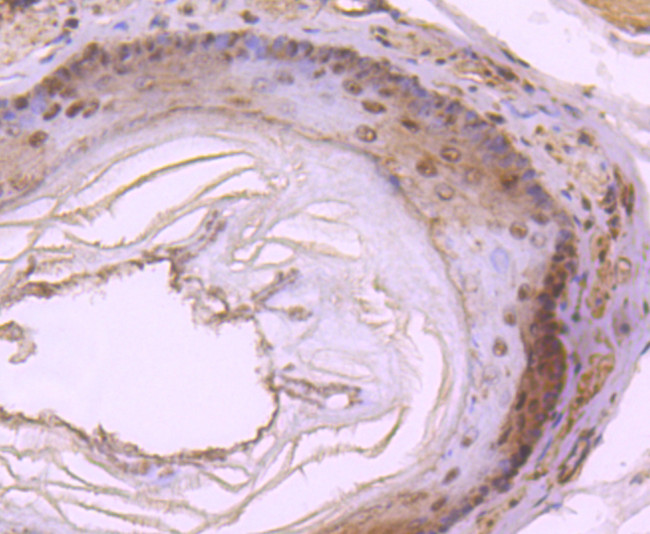 DYNLL1 Antibody in Immunohistochemistry (Paraffin) (IHC (P))