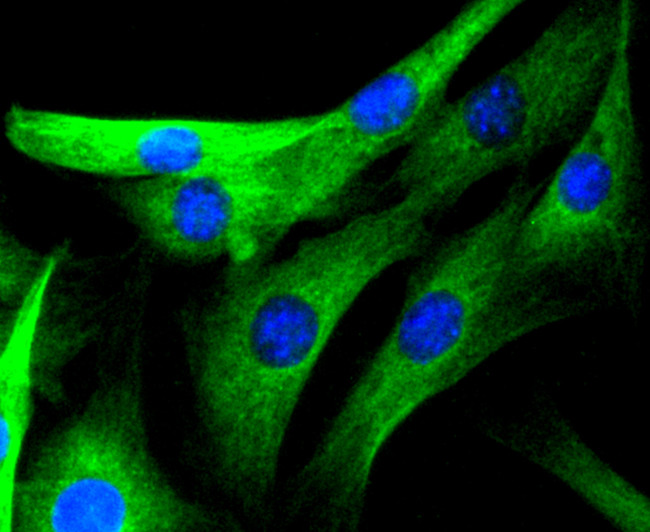 JNK3 Antibody in Immunocytochemistry (ICC/IF)