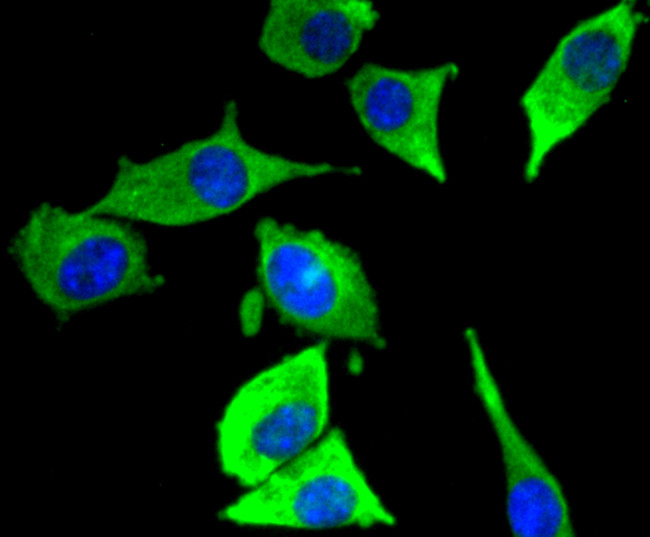 JNK3 Antibody in Immunocytochemistry (ICC/IF)