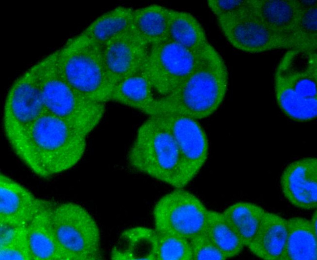 ERK5 Antibody in Immunocytochemistry (ICC/IF)