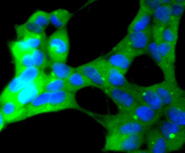 ERK5 Antibody in Immunocytochemistry (ICC/IF)