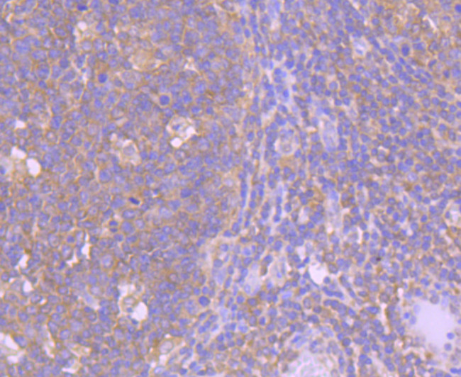 Caspase 8 Antibody in Immunohistochemistry (Paraffin) (IHC (P))