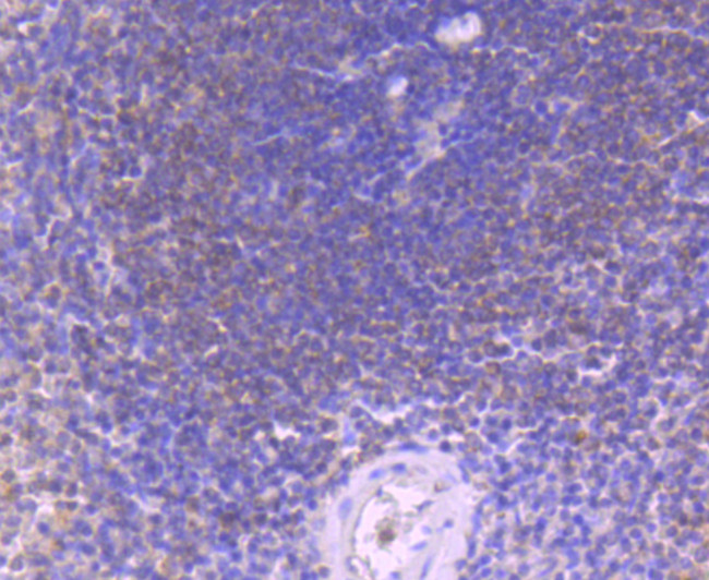 Caspase 8 Antibody in Immunohistochemistry (Paraffin) (IHC (P))